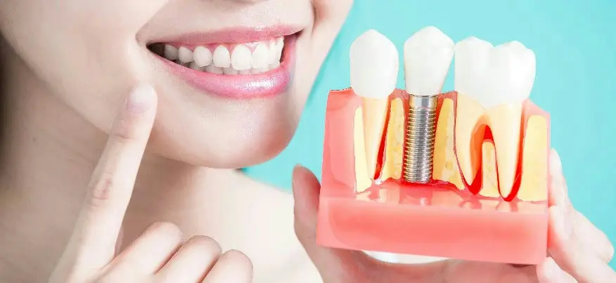 Tooth and root model held beside a smile
