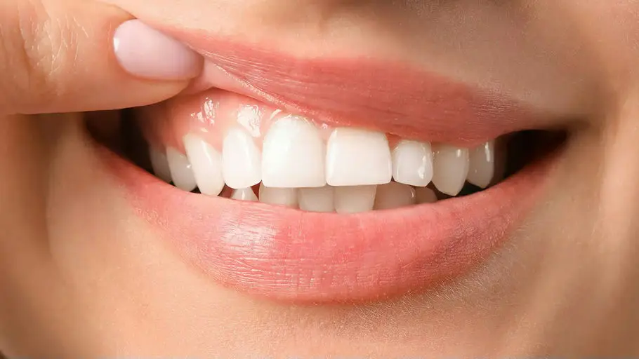 Close-up of teeth and the gum line